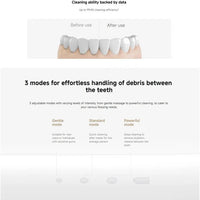 Xiaomi Water Flosser 2 MEO705 BHR9235GL